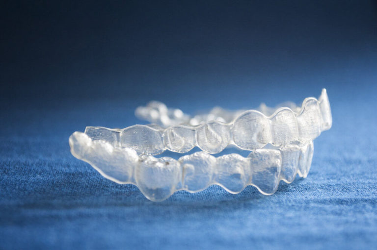 Clear Aligners Teeth Straightening Diamond Coast Dental