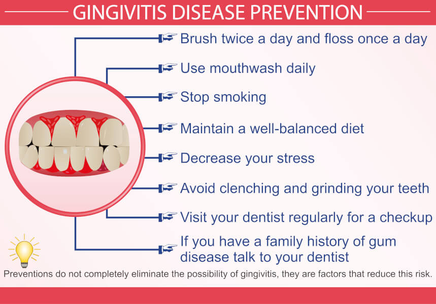 Gingivitis treatment and prevention