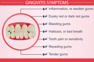 gingivitis